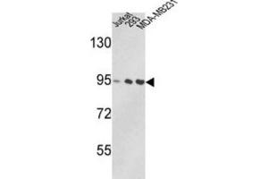 Western Blotting (WB) image for anti-Valosin Containing Protein (VCP) antibody (ABIN3002881) (VCP 抗体)