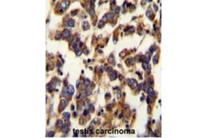 Immunohistochemistry (IHC) image for anti-Berardinelli-Seip Congenital Lipodystrophy 2 (Seipin) (BSCL2) antibody (ABIN2995527) (BSCL2 抗体)