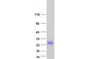 Western Blotting (WB) image for Achaete-Scute Complex Homolog 2 (ASCL2) protein (Myc-DYKDDDDK Tag) (ABIN2714975)