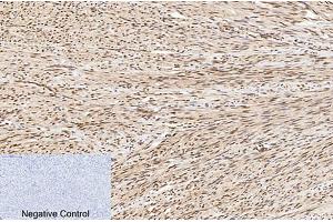 Immunohistochemical analysis of paraffin-embedded human uterus tissue. (PARP1 抗体  (Cleaved-Asp214))