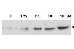 Western blot using  Affinity Purified anti-Chk2 pT68 antibody shows detection of a predominant band at ~60 kDa corresponding to phosphorylated Chk2 (arrowhead) in MCF-7 whole cell lysates after treatment with doxorubicin. (CHEK2 抗体  (pThr68))