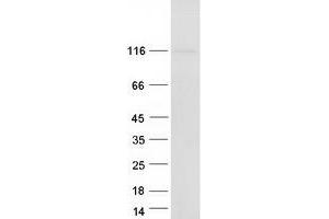 Western Blotting (WB) image for Bicaudal C Homolog 1 (BICC1) protein (Myc-DYKDDDDK Tag) (ABIN2715260)