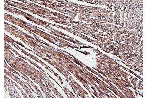 IHC analysis of ALDOA using anti-ALDOA antibody (ABIN7601907). (ALDOA 抗体  (AA 50-364))