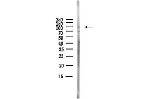Western blot analysis of lysates from PC12 cells(LPS,4h treatment), using Phospho-FGFR2 (Tyr586/Tyr588) Antibody at 1/1000 dilution.