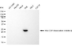 Western blotting analysis using Rho GDP dissociation inhibitor beta antibody (ABIN7800197).