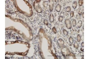 Immunoperoxidase of monoclonal antibody to ADAM17 on formalin-fixed paraffin-embedded human small Intestine. (ADAM17 抗体  (AA 215-314))