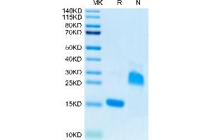 SDS-PAGE (SDS) image for Growth Differentiation Factor 15 (GDF15) (AA 189-303) protein (His tag) (ABIN7274731)