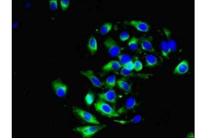 Immunofluorescent analysis of A549 cells using ABIN7149470 at dilution of 1:100 and Alexa Fluor 488-congugated AffiniPure Goat Anti-Rabbit IgG(H+L) (DRD5 抗体  (AA 361-477))