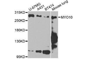 Western blot analysis of extracts of various cell lines, using MYO10 antibody. (Myosin X 抗体  (AA 845-944))