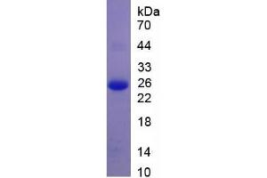 SDS-PAGE of Protein Standard from the Kit  (Highly purified E. (APOB ELISA 试剂盒)