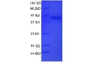 Synuclein, alpha (Non A4 Component of Amyloid Precursor) (SNCA) (AA 1-140) protein (His tag) expressed in E.