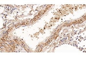 Detection of CNN1 in Human Lung Tissue using Polyclonal Antibody to Calponin 1, Basic (CNN1) (CNN1 抗体  (AA 1-268))