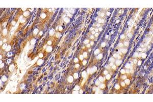 Immunohistochemistry (IHC) image for anti-Lectin, Galactoside-Binding, Soluble, 8 (LGALS8) (AA 1-317) antibody (ABIN7431593)