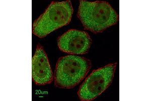 Immunofluorescence (IF) image for anti-Arachidonate 12-Lipoxygenase (ALOX12) antibody (ABIN3003946) (ALOX12 抗体)
