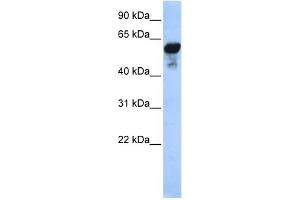 WB Suggested Anti-ALDH1B1 Antibody Titration: 0. (ALDH1B1 抗体  (Middle Region))