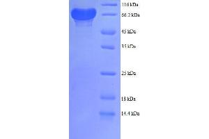 SDS-PAGE (SDS) image for Phosphogluconate Dehydrogenase (PGD) (AA 4-483), (partial) protein (GST tag) (ABIN7479188)