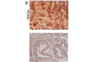 Immunohistochemistry (Paraffin-embedded Sections) (IHC (p)) image for anti-Wingless-Type MMTV Integration Site Family, Member 5A (WNT5A) (AA 301-381) antibody (ABIN675758)