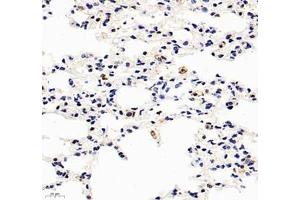 Immunohistochemistry of paraffin embedded mouse lung using HSP70B (ABIN7074173) at dilution of 1: 1000 (400x lens) (HSPA6 抗体)