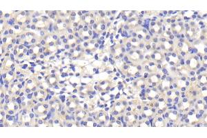 Detection of APOE in Mouse Kidney Tissue using Polyclonal Antibody to Apolipoprotein E (APOE) (APOE 抗体  (AA 14-167))