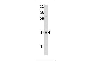 FKBP2 antibody  (N-Term)