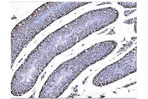 IHC analysis of KMT1B/SUV39H2 using anti-KMT1B/SUV39H2 antibody (ABIN7602135). (SUV39H2 抗体  (AA 6-410))
