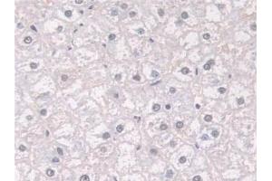 Detection of FKBP4 in Human Liver Tissue using Polyclonal Antibody to FK506 Binding Protein 4 (FKBP4)