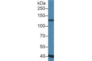 Detection of ADAMTS19 in Porcine Heart lysate using Polyclonal Antibody to A Disintegrin And Metalloproteinase With Thrombospondin 19 (ADAMTS19) (ADAMTS19 抗体  (AA 325-686))