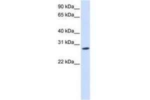 Image no. 1 for anti-Kv Channel Interacting Protein 4 (KCNIP4) (N-Term) antibody (ABIN6742500) (KCNIP4 抗体  (N-Term))