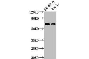 Western Blot Positive WB detected in: SH-SY5Y whole cell lysate, HepG2 whole cell lysate All lanes: C7orf31 antibody at 2. (C7orf31 抗体  (AA 163-256))