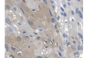 DAB staining on IHC-P; Samples: Human Esophagus (Arylsulfatase A 抗体  (AA 21-295))