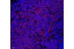 Immunofluorescence of paraffin embedded mouse thymus using Lat (ABIN7074502) at dilution of 1: 2100 (400x lens) (LAT 抗体)