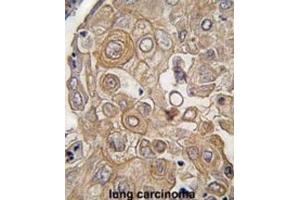 Immunohistochemistry (IHC) image for anti-Toll-Like Receptor 6 (TLR6) antibody (ABIN2998415)