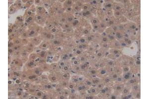 IHC-P analysis of Mouse Liver Tissue, with DAB staining. (SIRT3 抗体  (AA 5-257))
