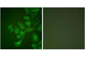 Immunofluorescence analysis of A549 cells, using TIMP2 Antibody. (TIMP2 抗体  (AA 21-70))