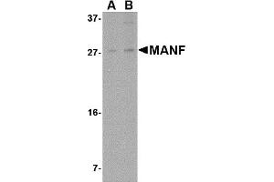 Western Blotting (WB) image for anti-Mesencephalic Astrocyte-Derived Neurotrophic Factor (MANF) (N-Term) antibody (ABIN1031449) (MANF 抗体  (N-Term))