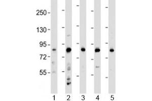 Western blot testing of human 1) HeLa, 2) HL-60, 3) THP-1, 4) CCRF-CEM and 5) SH-SY5Y cell lysate with LRCH4 antibody at 1:2000. (LRCH4 抗体  (AA 305-348))