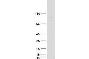 Western Blotting (WB) image for Fibulin 1 (FBLN1) (Transcript Variant D) protein (Myc-DYKDDDDK Tag) (ABIN2721179)