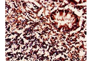 Immunohistochemistry of paraffin-embedded human appendix tissue using ABIN7142447 at dilution of 1:100