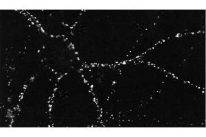 ICC of PSD95 in cultures of dissociated hippocampal neurons. (DLG4 抗体  (Atto 390))