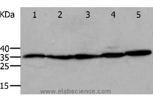 Western blot analysis of Mouse eyes and heart, Human cervical cancer tissue, OP9 and RAW264. (Annexin V 抗体)