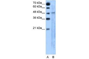 SLC25A46 antibody used at 5 ug/ml to detect target protein. (SLC25A46 抗体  (N-Term))