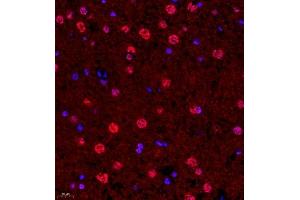 Immunofluorescence of paraffin embedded rat brain using SUV39H1 (ABIN7075770) at dilution of 1:1000 (400x lens) (SUV39H1 抗体)