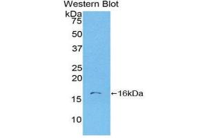 Western Blotting (WB) image for anti-S100 Calcium Binding Protein A6 (S100A6) (AA 1-90) antibody (ABIN3201618)