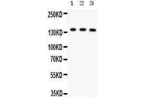 Anti- ABCB11 Picoband antibody, Western blotting All lanes: Anti ABCB11  at 0. (ABCB11 抗体  (C-Term))
