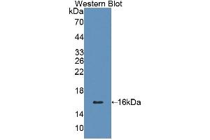 Detection of Recombinant CD7, Human using Polyclonal Antibody to Cluster Of Differentiation 7 (CD7) (CD7 抗体  (AA 26-134))