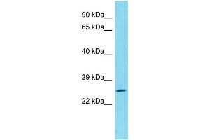 Host: Rabbit Target Name: C1orf105 Sample Type: HepG2 Whole Cell lysates Antibody Dilution: 1. (C1ORF105 抗体  (N-Term))