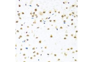 Immunohistochemistry of paraffin-embedded mouse brain using RAB3IP antibody at dilution of 1:100 (x40 lens). (RAB3IP 抗体)