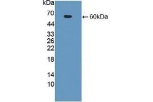 Detection of Recombinant CECR1, Human using Polyclonal Antibody to Cat Eye Syndrome Chromosome Region, Candidate 1 (CECR1) (CECR1 抗体  (AA 30-511))