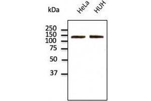 Endogenous CDH2 detected with at 1/500 dilution; lysates at 100 µg per lane and rabbit polyclonal to goat lgG (HRP) at 1/10,000 dilution. (N-Cadherin 抗体  (C-Term))