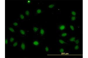 Immunofluorescence of monoclonal antibody to LASS4 on HeLa cell. (LASS4 抗体  (AA 57-139))